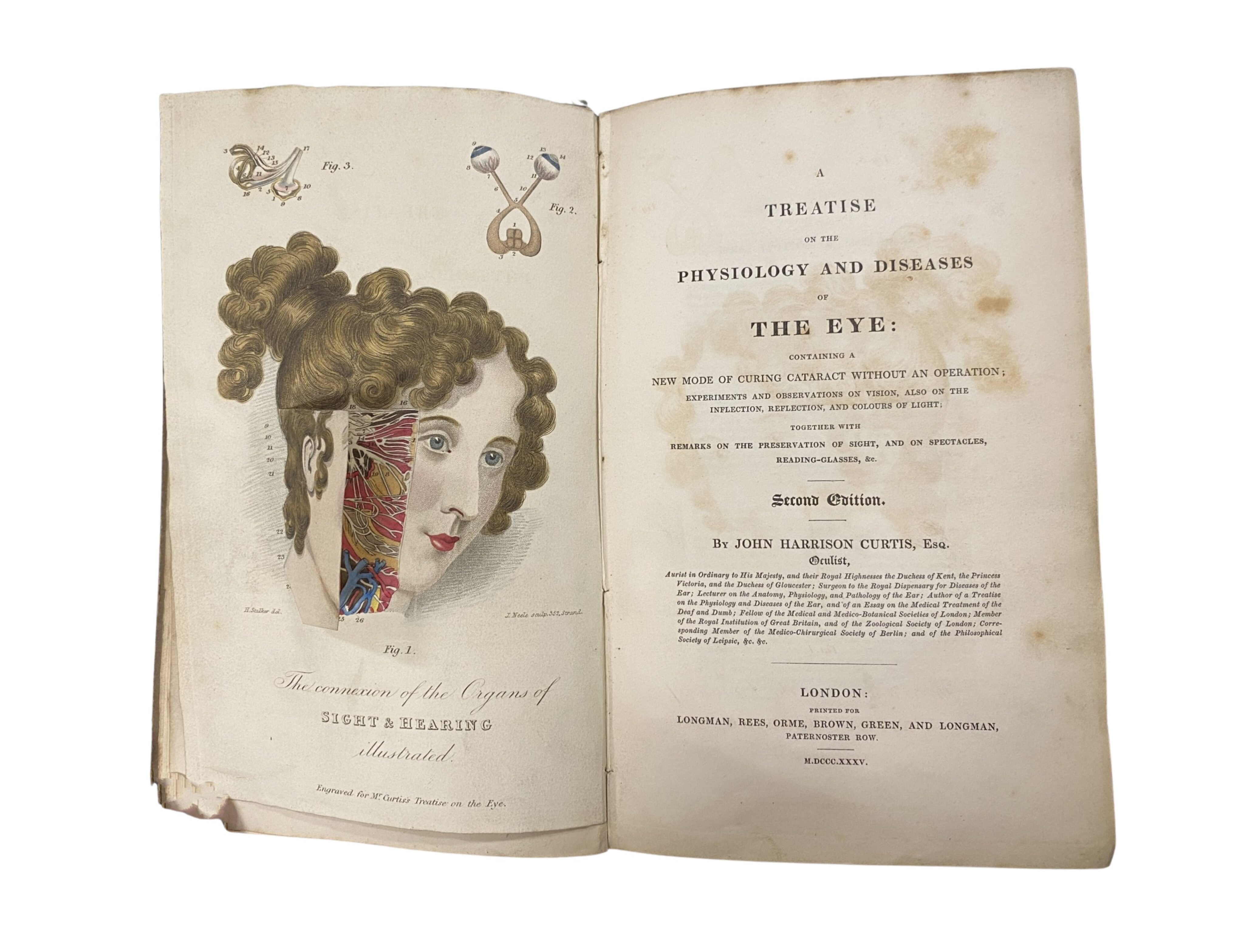 Open pages of the 1835 medical book 'A Treatise on the Physiology and Diseases of the Eye' by John Harrison Curtis. The left page displays an anatomical illustration of a woman's head with the skin removed on one side to show the underlying muscles and blood vessels. The right page shows the book's title and publication details.